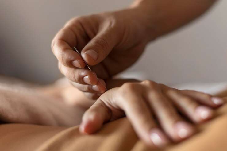 close up hand holding acupuncture needle 23 2148815315